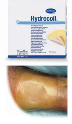 Hydrocoll Medicazione Idrocolloidale Sterile 10X10