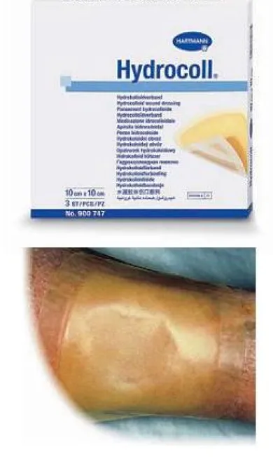 Hydrocoll Medicazione Idrocolloidale Sterile 10X10